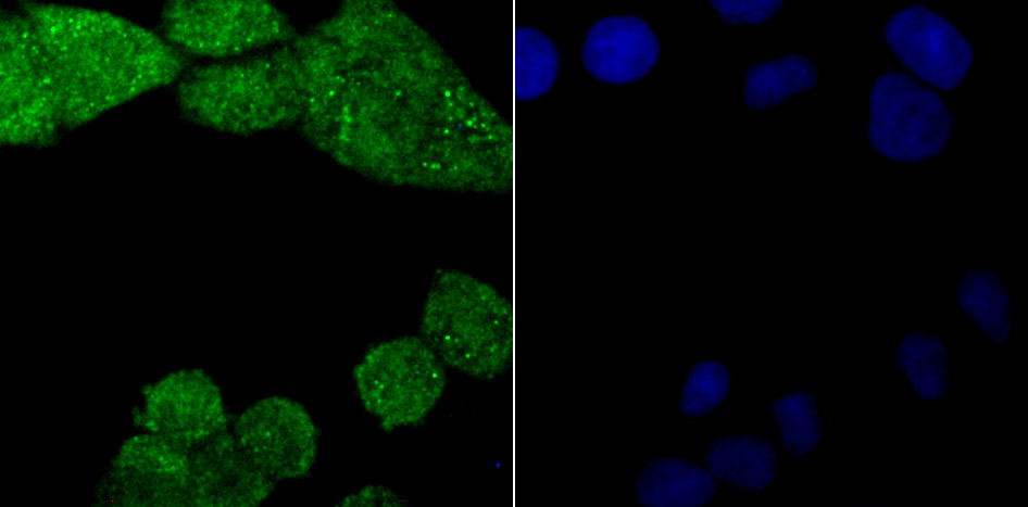 PKC beta Antibody