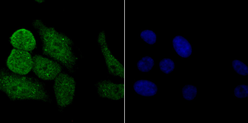 PKC beta Antibody