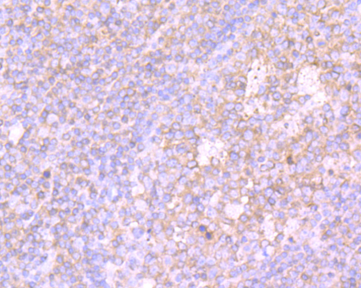 PKC beta Antibody