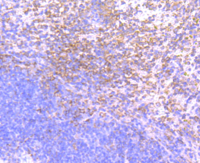 PKC beta Antibody