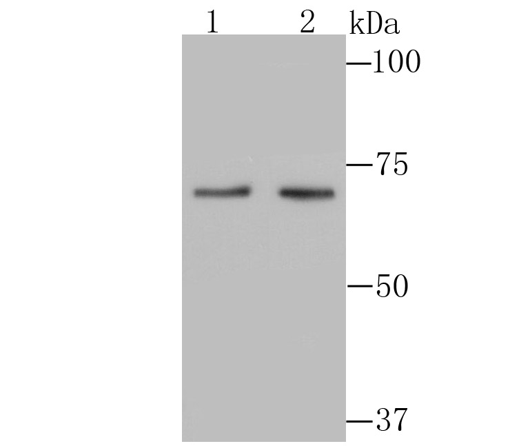 PKC beta Antibody