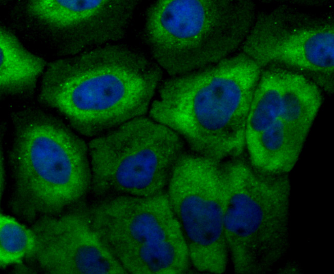 Mitofusin 2 Antibody