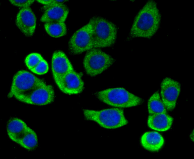 Mitofusin 2 Antibody