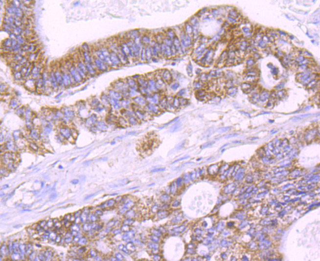 IL1 alpha Antibody