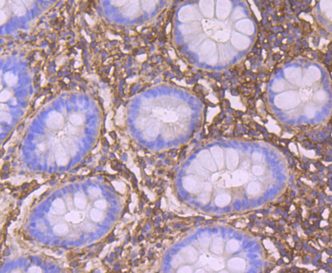 CRMP2 Antibody