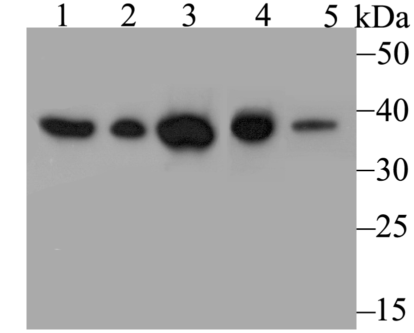 Annexin A3 Antibody