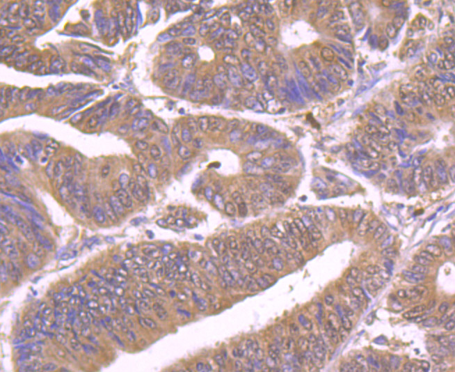 Hip1 Antibody