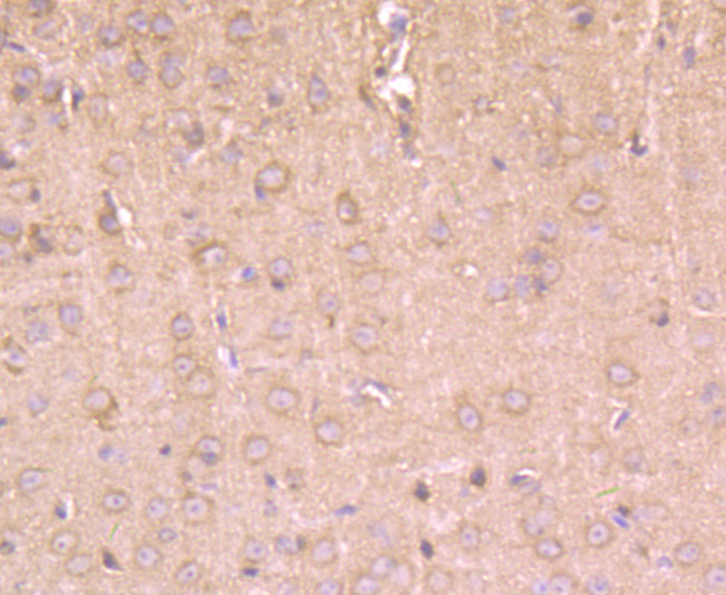 Hip1 Antibody