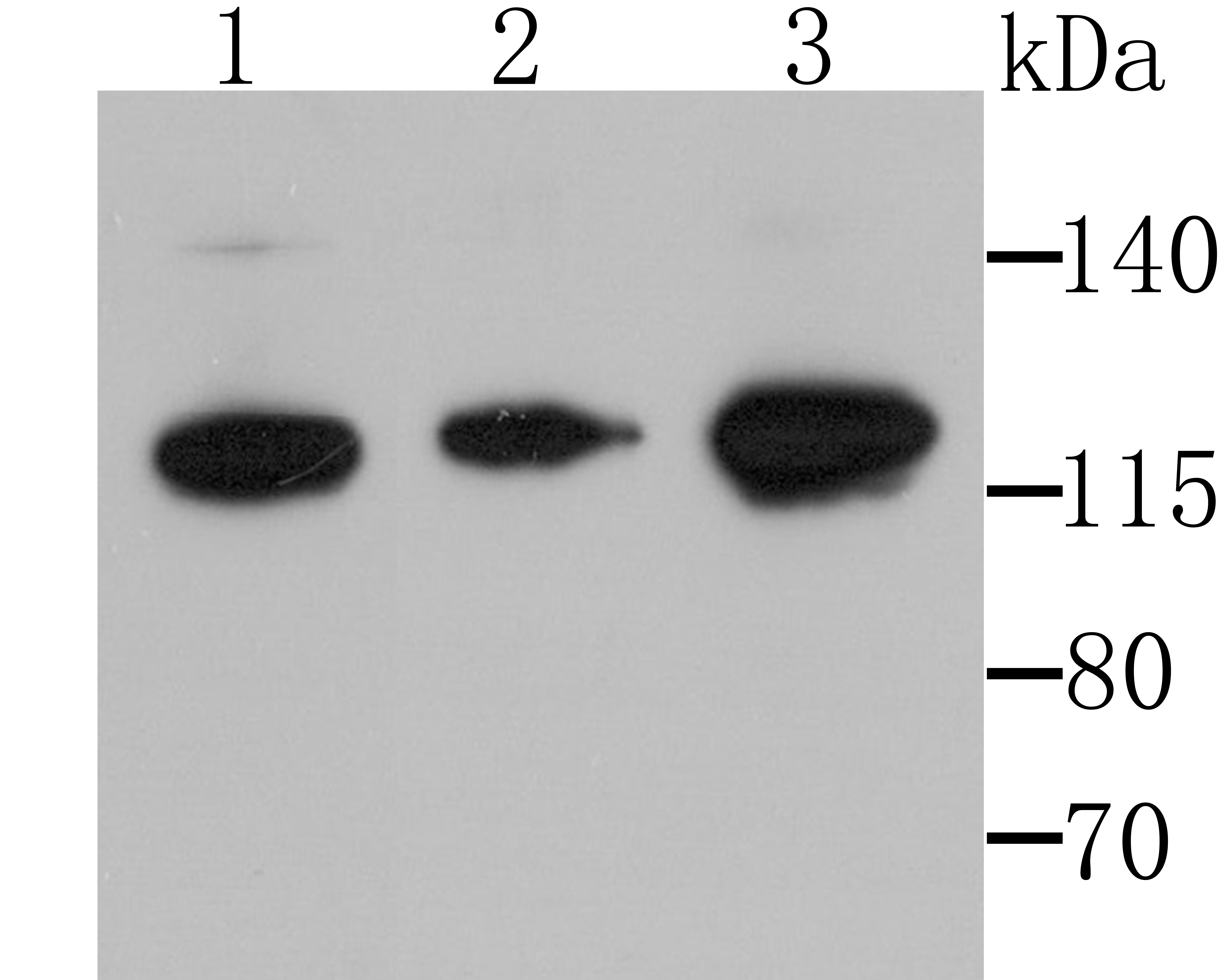 Hip1 Antibody