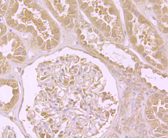 DIAPH3 Antibody