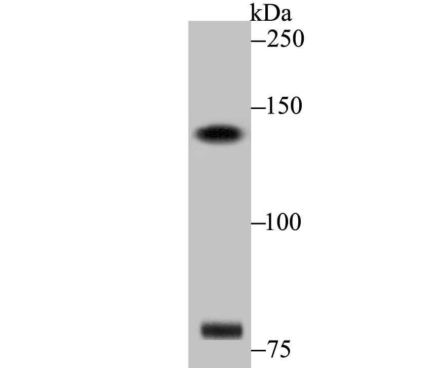 DIAPH3 Antibody