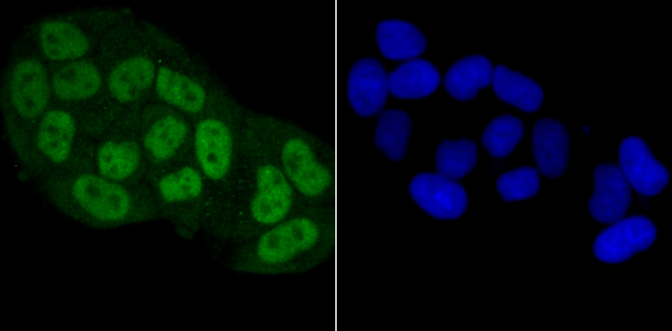 BubR1 Antibody