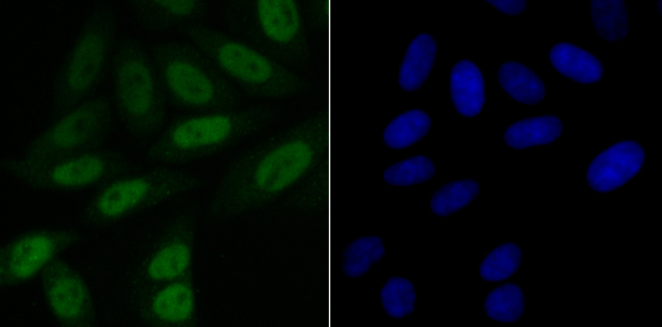 BubR1 Antibody