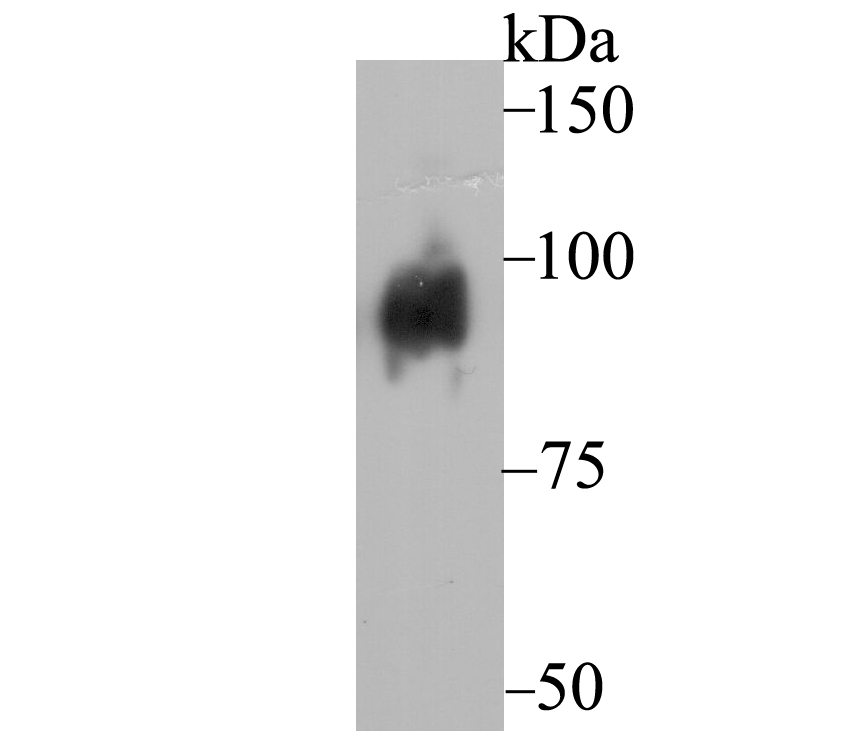 Dynamin 1 Antibody