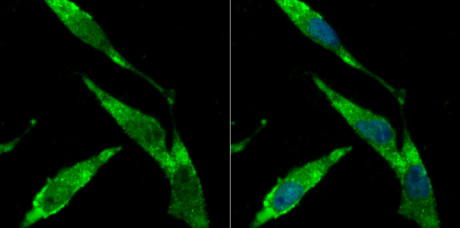 BHLHB9 Antibody