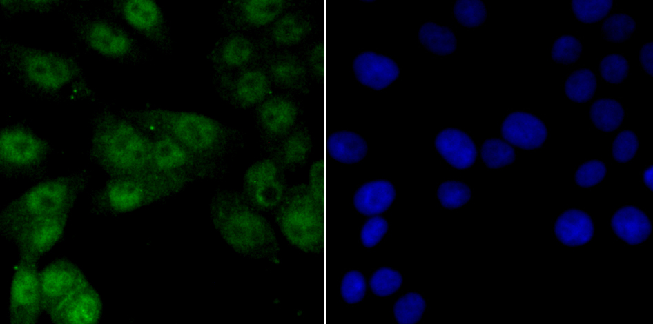 Vitamin D3 Receptor Antibody