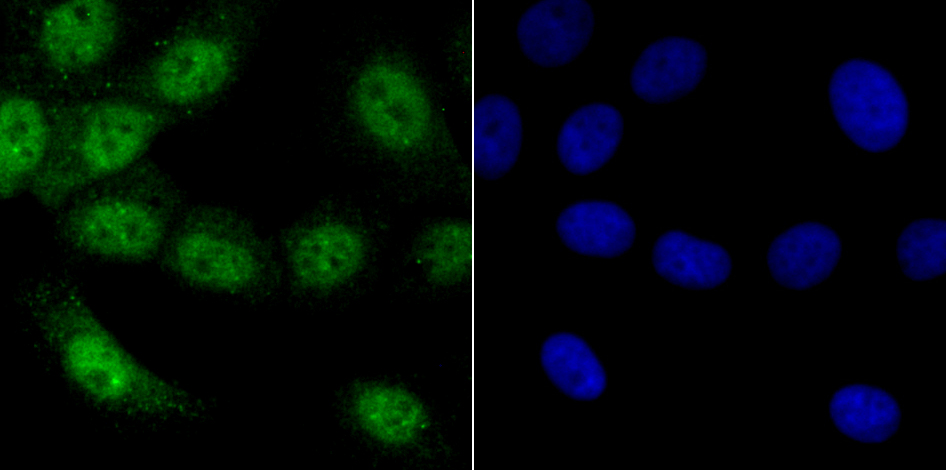 Vitamin D3 Receptor Antibody