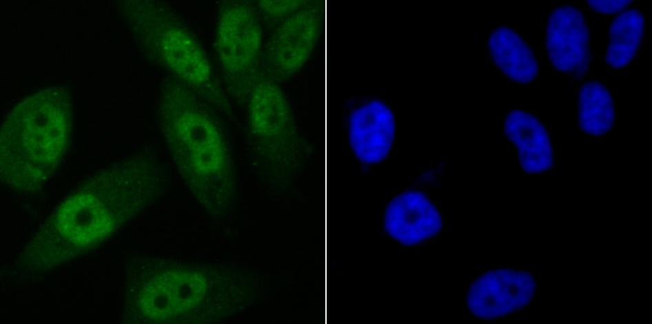 Vitamin D3 Receptor Antibody