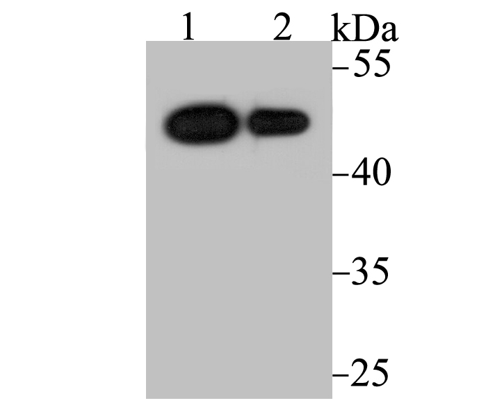 Vitamin D3 Receptor Antibody