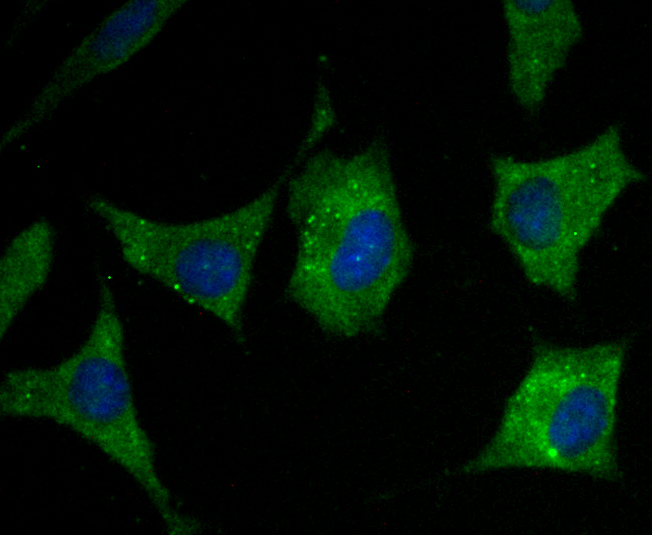 RYR2 Antibody