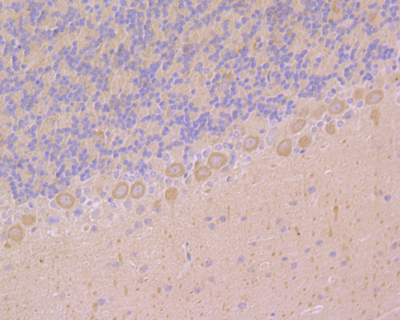 RYR2 Antibody