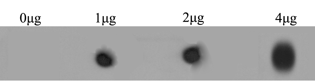 RYR2 Antibody