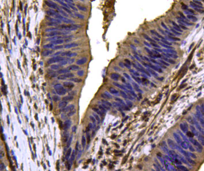 VCP Antibody