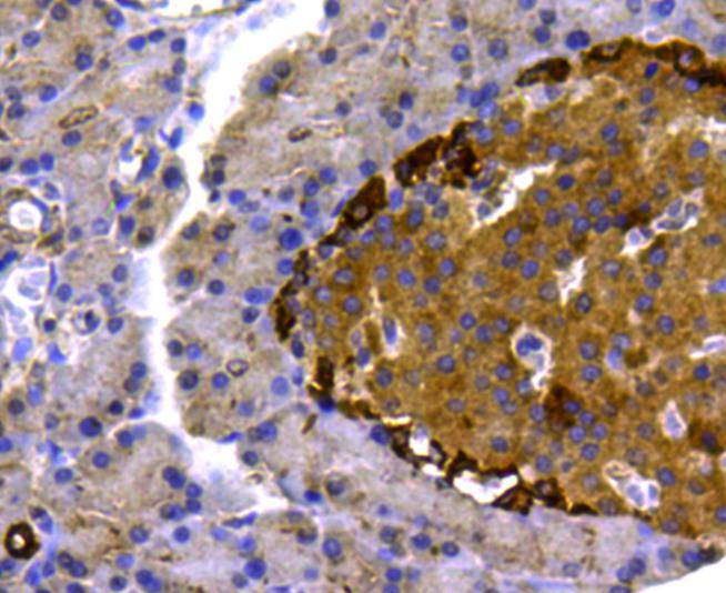 p70 S6 Kinase beta Antibody