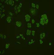 MMP1 Antibody