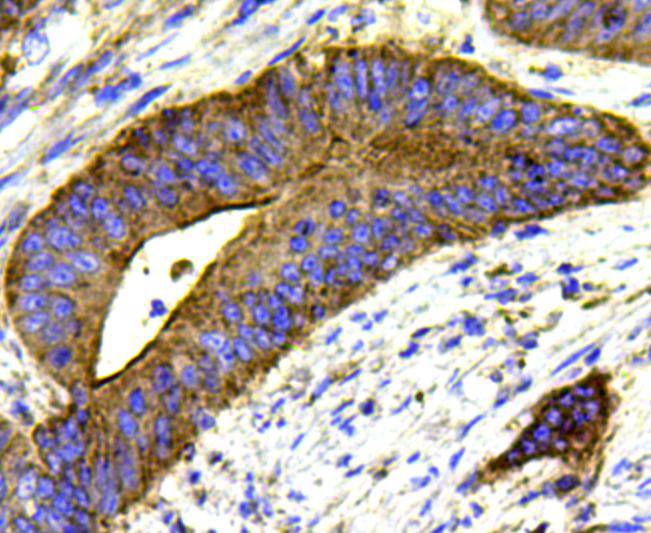 MMP1 Antibody