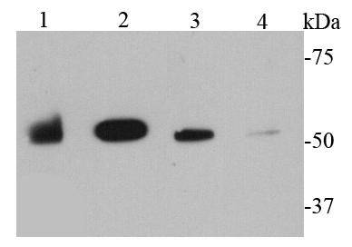 MMP1 Antibody