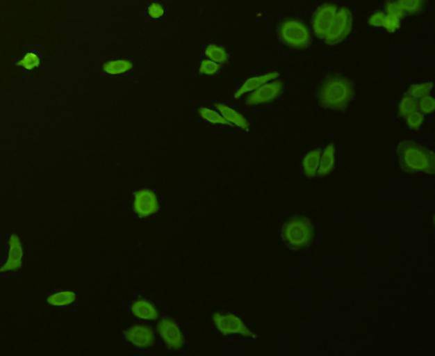 Stat-1 alpha/beta Antibody