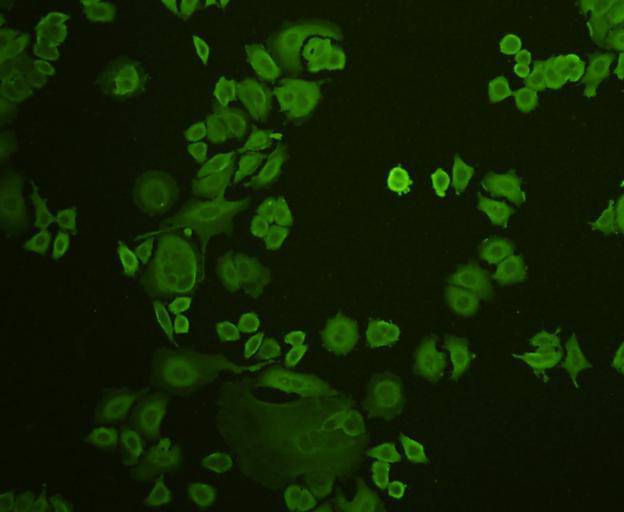 Stat-1 alpha/beta Antibody