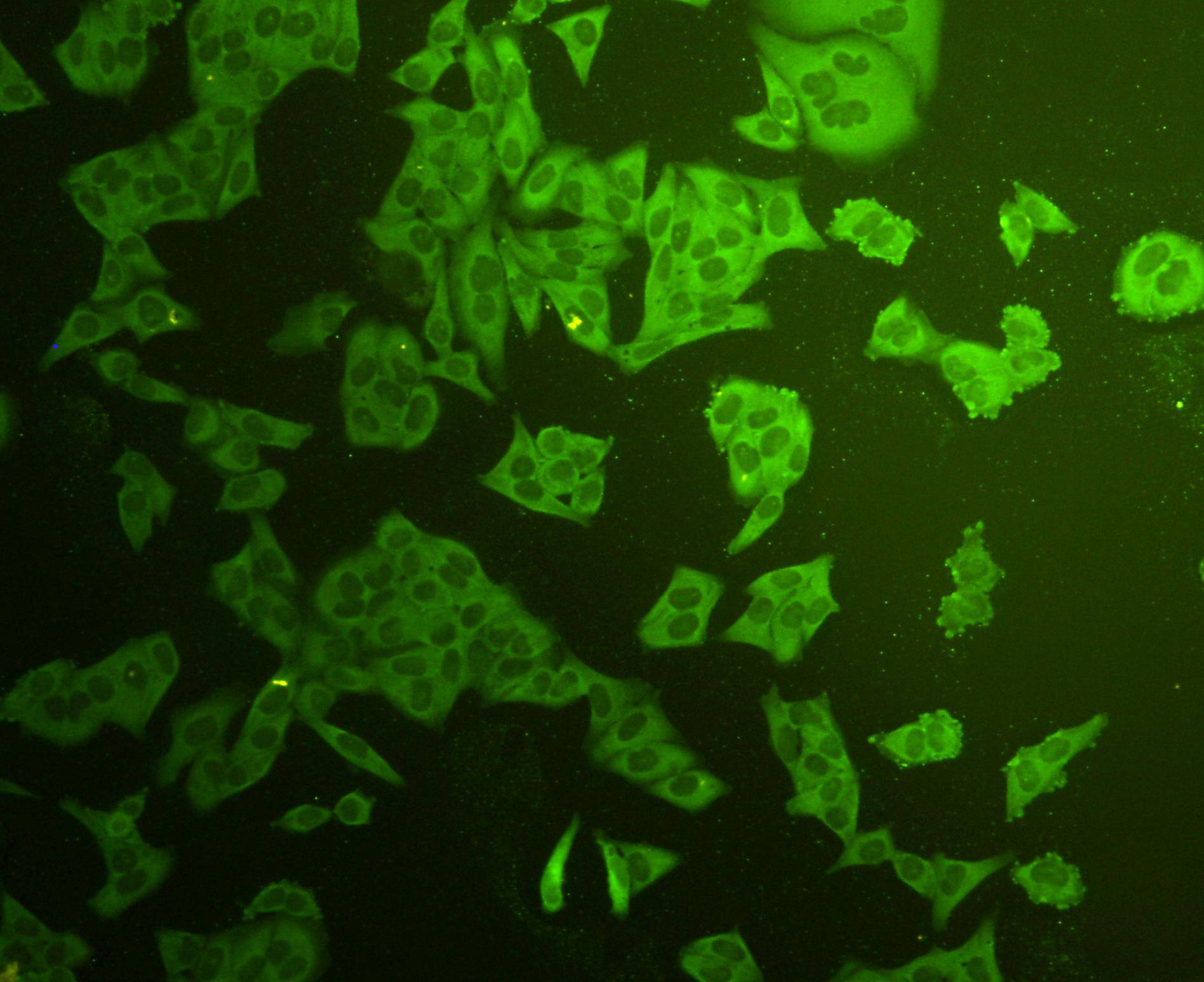 Stat-1 alpha/beta Antibody