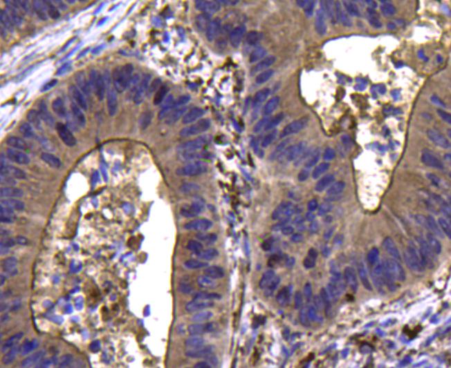 CDK6 Antibody