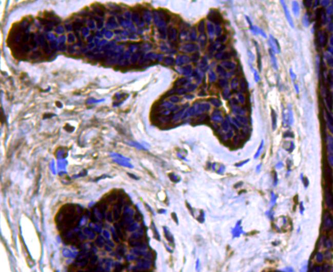 CDK6 Antibody