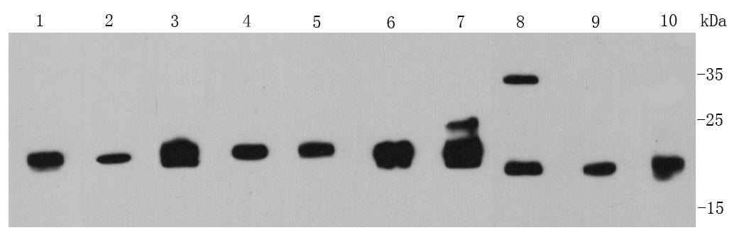 MGMT Antibody