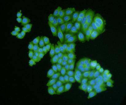 Desmin Antibody