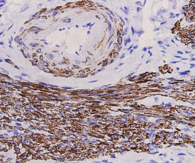 Desmin Antibody