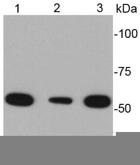 Desmin Antibody