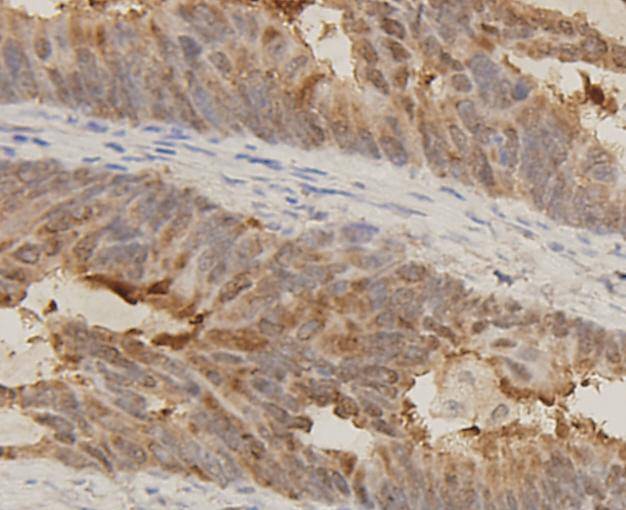 MMP2 Antibody