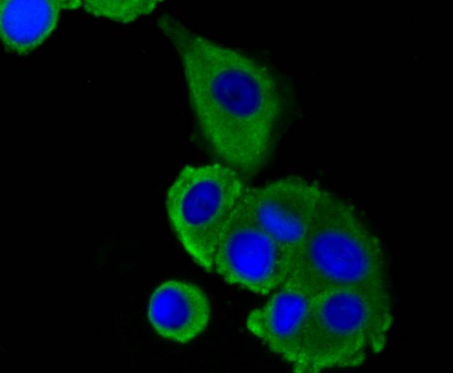 LRP1 Rabbit mAb