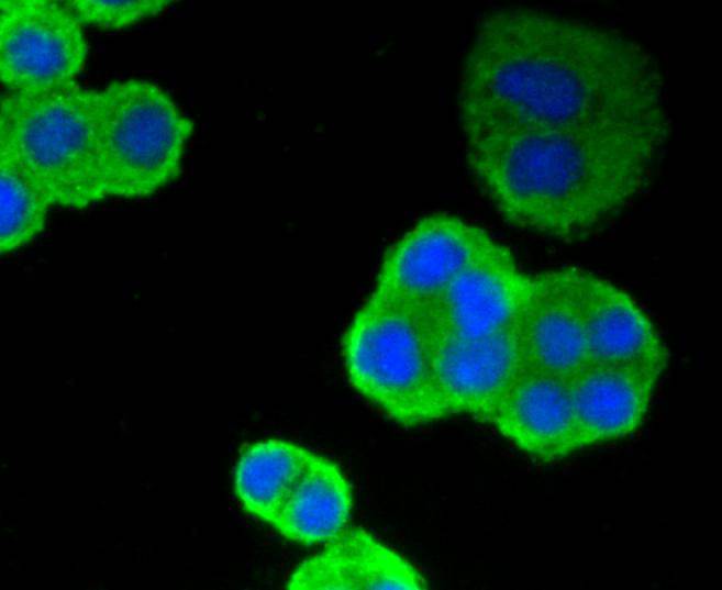 p53 Rabbit mAb