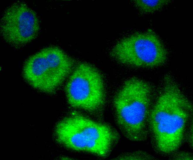 VCAM1 Rabbit mAb