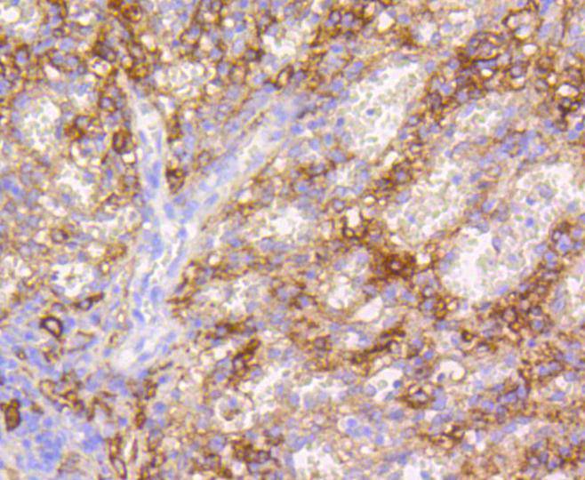 VCAM1 Rabbit mAb