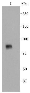 VCAM1 Rabbit mAb