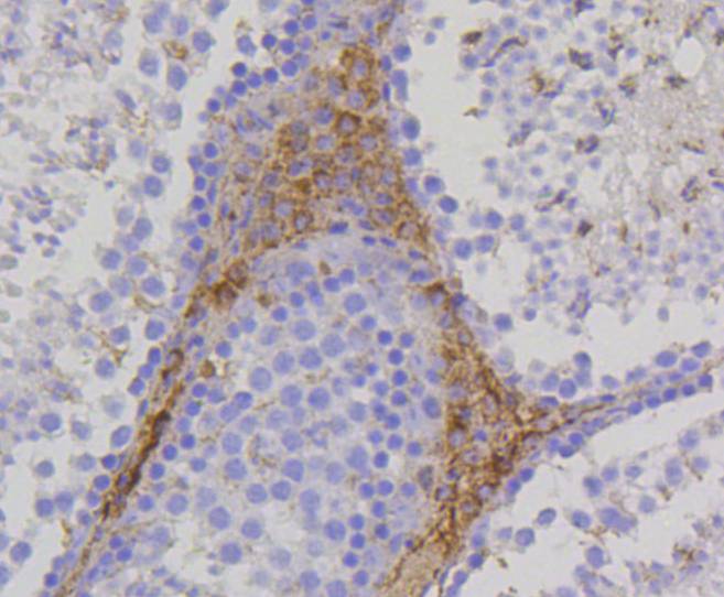 PBR Rabbit mAb