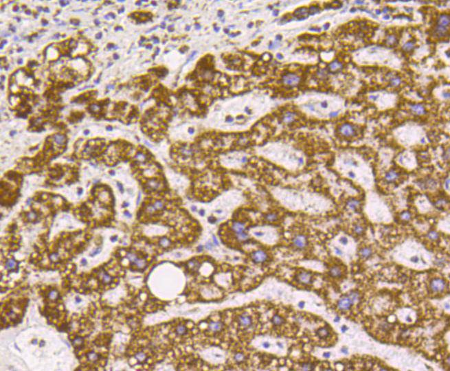 VDAC1 Rabbit mAb