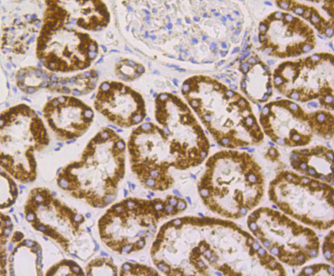 VDAC1 Rabbit mAb