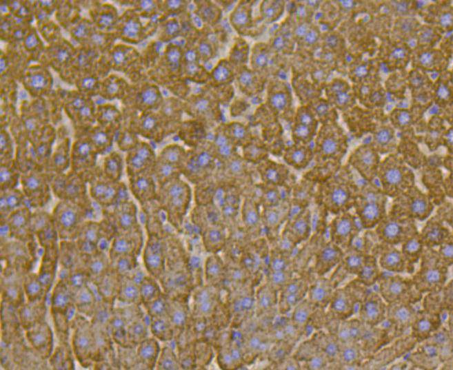 VDAC1 Rabbit mAb